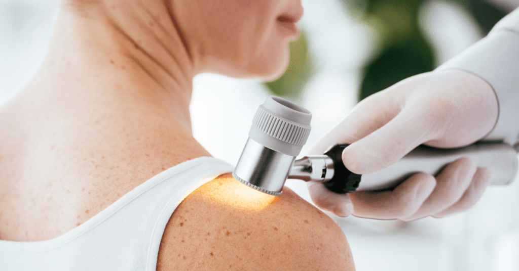 Melanoma Symptoms and Causes: How to Detect Skin Cancer Early Melanoma Symptoms and Causes: How to Detect Skin Cancer Early