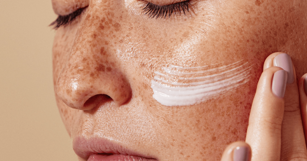 Healthy, even-toned skin representing the improvement of hyperpigmentation through proper skincare.