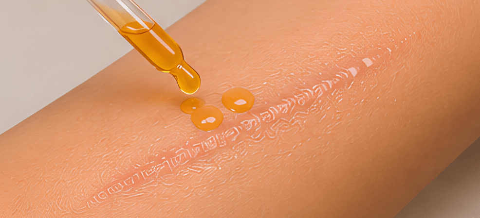 Take 2-3 drops of rosehip oil.