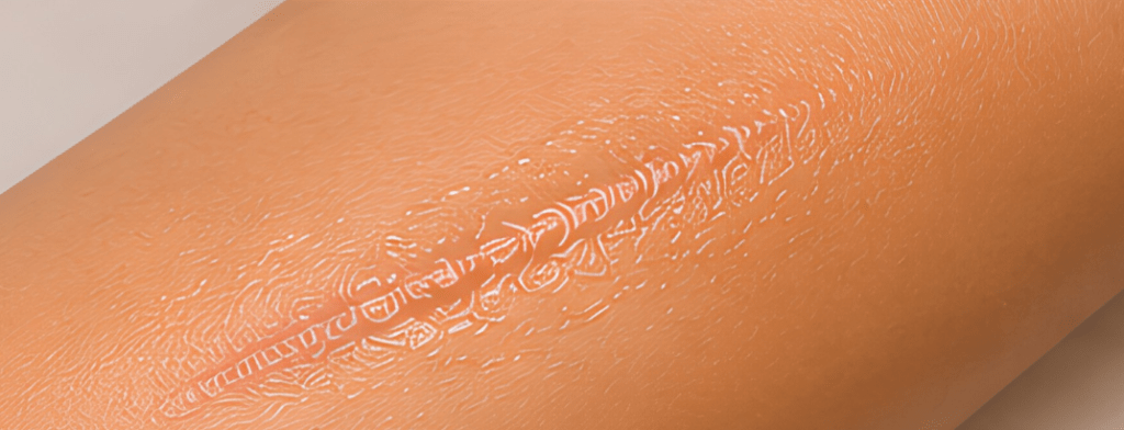 Continue rubbing until the oil  is fully absorbed.