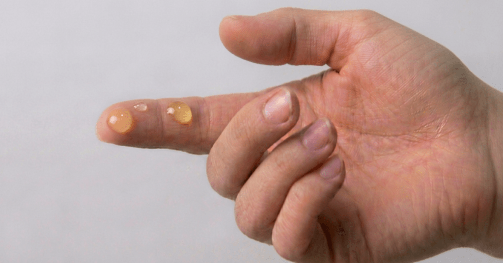 Place 2-3 drops of the blend onto your fingertips. Place 2-3 drops of the blend onto your fingertips.