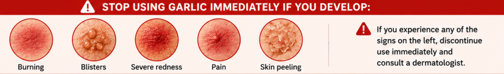 Stop using garlic immediately if you develop: Burning Blisters Severe redness Pain Skin peeling