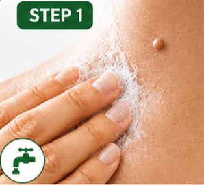 Step 1: Wash the affected area 