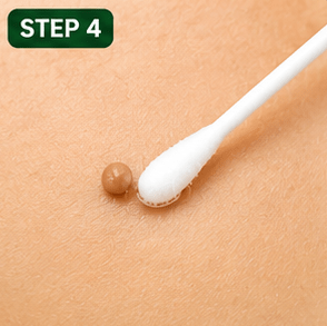 Step 4: Gently apply the oil directly onto the skin tag. 