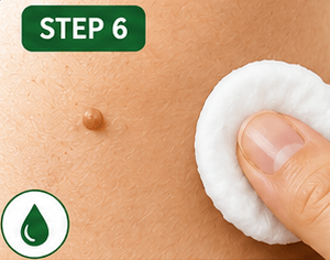 Step 6: Remove the cotton